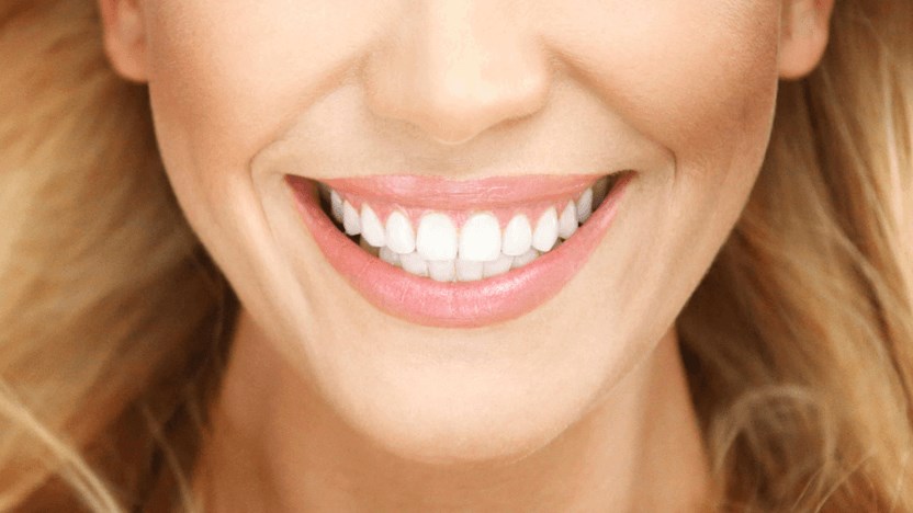 woman with smile enhancement o